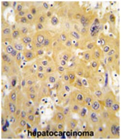 TYMP, Rabbit, Polyclonal Antibody, Abnova 400 &mu;L | Buy Online | Abnova Corporation | Fisher Scientific