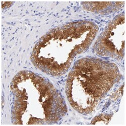 RAB3B, Rabbit, Polyclonal Antibody, Abnova 100&mu;L; Unlabeled:Antibodies,