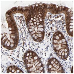 LGALS3 Rabbit anti-Human, Polyclonal Antibody, Abnova 100 &mu;L | Buy Online | Abnova Corporation | Fisher Scientific