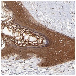 TNRC6B, Rabbit, Polyclonal Antibody, Abnova 100 &mu;L | Buy Online | Abnova Corporation | Fisher Scientific