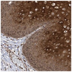 ZKSCAN5, Rabbit, Polyclonal Antibody, Abnova 100&mu;L; Unlabeled:Antibodies,
