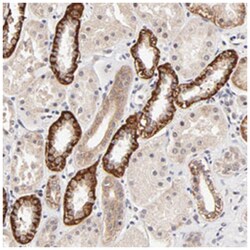 ZNF10, Rabbit, Polyclonal Antibody, Abnova 100 &mu;L | Buy Online | Abnova Corporation | Fisher Scientific