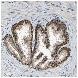 PSMD5, Rabbit, Polyclonal Antibody, Abnova 100 &mu;L | Buy Online | Abnova Corporation | Fisher Scientific