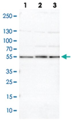 PSMD5, Rabbit, Polyclonal Antibody, Abnova 100 &mu;L | Buy Online | Abnova Corporation | Fisher Scientific