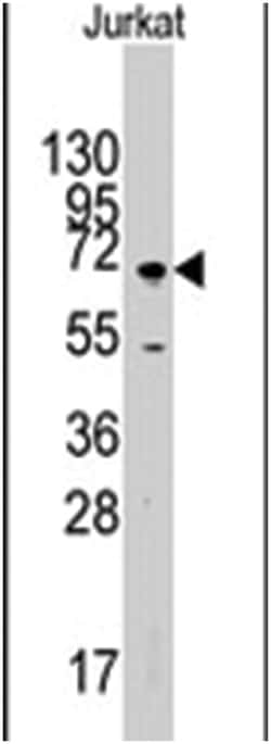 MAPK4, Rabbit, Polyclonal Antibody, Abnova 400 &mu;L | Buy Online | Abnova Corporation | Fisher Scientific