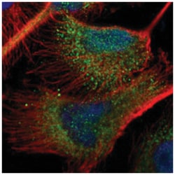 ZNF155, Rabbit, Polyclonal Antibody, Abnova 100 &mu;L | Buy Online | Abnova | Fisher Scientific