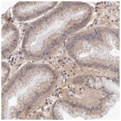 PCMT1, Rabbit, Polyclonal Antibody, Abnova 100&mu;L; Unlabeled:Antibodies,