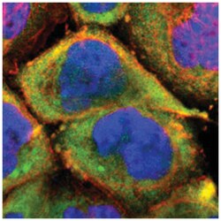 PCMT1, Rabbit, Polyclonal Antibody, Abnova 100&mu;L; Unlabeled:Antibodies,