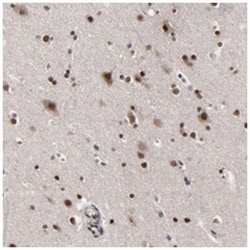 ZNF777, Rabbit, Polyclonal Antibody, Abnova 100&mu;L; Unlabeled:Antibodies,