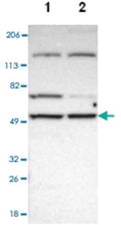 MIPOL1, Rabbit, Polyclonal Antibody, Abnova 100 &mu;L | Buy Online | Abnova Corporation | Fisher Scientific
