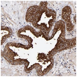 MIPOL1, Rabbit, Polyclonal Antibody, Abnova 100 &mu;L | Buy Online | Abnova Corporation | Fisher Scientific