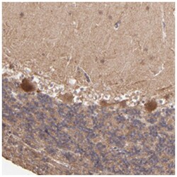 ZFYVE1 Rabbit anti-Human, Polyclonal Antibody, Abnova 100 &mu;L | Buy Online | Abnova Corporation | Fisher Scientific