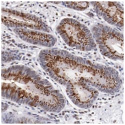 BEGAIN, Rabbit, Polyclonal Antibody, Abnova 100&mu;L; Unlabeled:Antibodies,