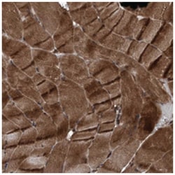 PLXNB2, Rabbit, Polyclonal Antibody, Abnova 100 &mu;L | Buy Online | Abnova Corporation | Fisher Scientific