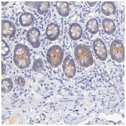 GPHN, Rabbit, Polyclonal Antibody, Abnova 100 &mu;L | Buy Online | Abnova Corporation | Fisher Scientific