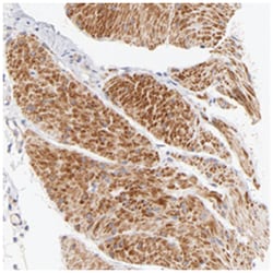 ACTRT1, Rabbit, Polyclonal Antibody, Abnova 100 &mu;L | Buy Online | Abnova Corporation | Fisher Scientific