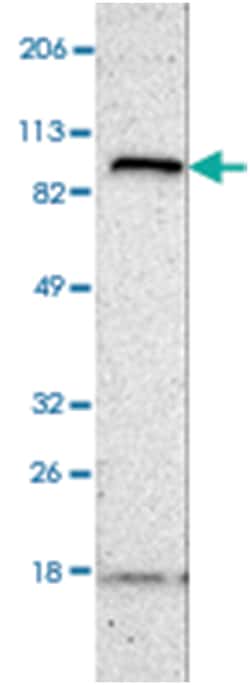 FANCB, Rabbit, Polyclonal Antibody, Abnova 100 &mu;L | Buy Online | Abnova Corporation | Fisher Scientific