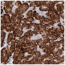 FANCB, Rabbit, Polyclonal Antibody, Abnova 100 &mu;L | Buy Online | Abnova Corporation | Fisher Scientific