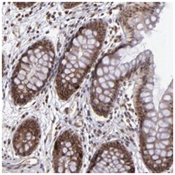 EP300 Rabbit anti-Human, Polyclonal Antibody, Abnova 100&mu;L; Unlabeled:Antibodies,