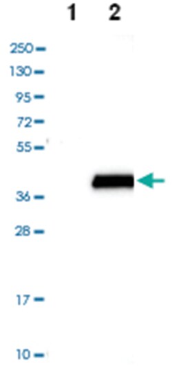 SULT4A1 Rabbit anti-Human, Polyclonal Antibody, Abnova 100 &mu;L | Buy Online | Abnova Corporation | Fisher Scientific