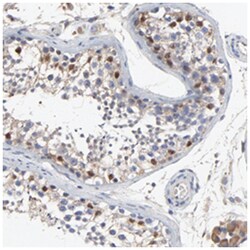 NXF3 Rabbit anti-Human, Polyclonal Antibody, Abnova 100 &mu;L | Buy Online | Abnova | Fisher Scientific