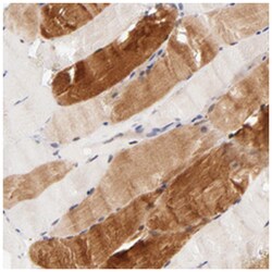 AFF2, Rabbit, Polyclonal Antibody, Abnova 100 &mu;L | Buy Online | Abnova Corporation | Fisher Scientific