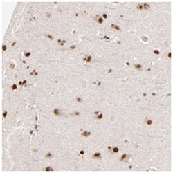 ZNF670, Rabbit, Polyclonal Antibody, Abnova 100&mu;L; Unlabeled:Antibodies,
