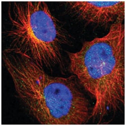 ZNF44, Rabbit, Polyclonal Antibody, Abnova 100&mu;L; Unlabeled:Antibodies,