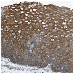 ZNF558, Rabbit, Polyclonal Antibody, Abnova 100&mu;L; Unlabeled:Antibodies,