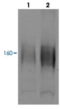 SLC12A3 Rabbit anti-Human, Mouse, Rat, Polyclonal Antibody, Abnova 100&mu;g;