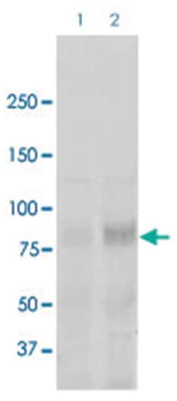 Scnn1a, Rabbit, Polyclonal Antibody, Abnova 100 &mu;g | Buy Online | Abnova Corporation | Fisher Scientific