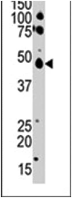 CSNK1E Rabbit anti-Human, Polyclonal Antibody, Abnova 400 &mu;L | Buy Online | Abnova Corporation | Fisher Scientific