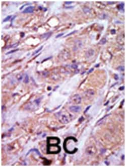 CSNK1E Rabbit anti-Human, Polyclonal Antibody, Abnova 400 &mu;L | Buy Online | Abnova Corporation | Fisher Scientific
