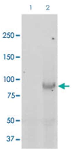 SCNN1B Rabbit anti-Human, Mouse, Rat, Polyclonal Antibody, Abnova 100 &mu;g | Buy Online | Abnova Corporation | Fisher Scientific