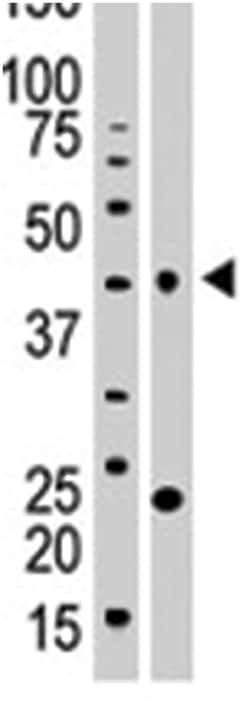 VRK1, Rabbit, Polyclonal Antibody, Abnova 400&mu;L; Unlabeled:Antibodies,