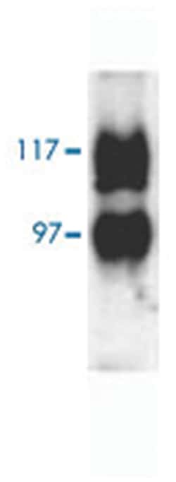 Slc14a2, Rabbit, Polyclonal Antibody, Abnova 100 &mu;g | Buy Online | Abnova Corporation | Fisher Scientific