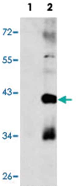 MAPK11 Rabbit anti-Human, Polyclonal Antibody, Abnova 400 &mu;L | Buy Online | Abnova Corporation | Fisher Scientific