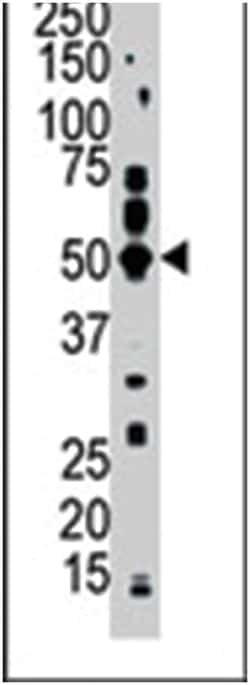 PFTK2, Rabbit, Polyclonal Antibody, Abnova 400 &mu;L | Buy Online | Abnova | Fisher Scientific