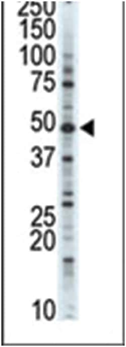 CDK10, Rabbit, Polyclonal Antibody, Abnova 400 &mu;L | Buy Online | Abnova Corporation | Fisher Scientific