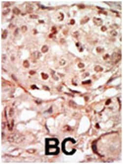 CDK10, Rabbit, Polyclonal Antibody, Abnova 400 &mu;L | Buy Online | Abnova Corporation | Fisher Scientific