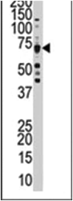 CDK8 Rabbit anti-Human, Polyclonal Antibody, Abnova 400 &mu;L | Buy Online | Abnova Corporation | Fisher Scientific