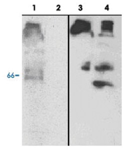 SPP1 (Osteopontin-c), Chicken, Polyclonal Antibody, Abnova 100&mu;g; Unlabeled:Anticuerpos