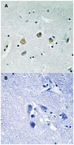 MAP3K8 (phospho S400), Rabbit anti-Human, Mouse, Rat, Polyclonal Antibody, Abnova 100 &mu;L | Buy Online | Abnova Corporation | Fisher Scientific