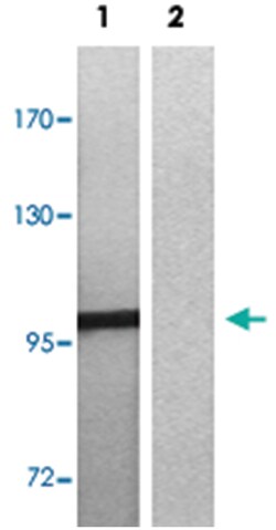 MERTK/TYRO3, Rabbit, Polyclonal Antibody, Abnova 100&mu;L; Unlabeled:Antibodies,