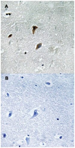 MAP2K3 (phospho T222), Rabbit anti-Human, Mouse, Rat, Polyclonal Antibody, Abnova 100 &mu;L | Buy Online | Abnova Corporation | Fisher Scientific