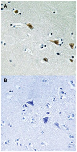 MAP2K7 (phospho S271), Rabbit anti-Human, Mouse, Rat, Polyclonal Antibody,