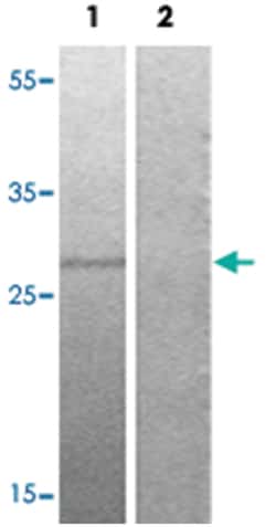OXSR1, Rabbit, Polyclonal Antibody, Abnova 100 &mu;L | Buy Online | Abnova Corporation | Fisher Scientific