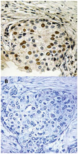 OXSR1, Rabbit, Polyclonal Antibody, Abnova 100 &mu;L | Buy Online | Abnova Corporation | Fisher Scientific