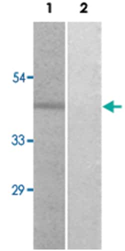 PAK1 (phospho S204), Rabbit anti-Human, Mouse, Rat, Polyclonal Antibody, Abnova 100 &mu;L | Buy Online | Abnova Corporation | Fisher Scientific