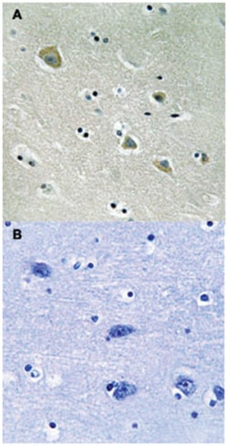 PAK1 (phospho S204), Rabbit anti-Human, Mouse, Rat, Polyclonal Antibody, Abnova 100 &mu;L | Buy Online | Abnova Corporation | Fisher Scientific